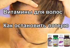 Выпадение волос: какие витамины нужны, лучшие витамины против облысения